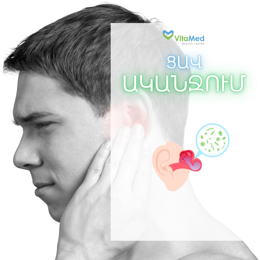 ՑԱՎ ԱԿԱՆՋՈՒՄ․ ՊԱՏՃԱՌՆԵՐԸ, ԱԽՏՈՐՈՇՈՒՄԸ, ԲՈՒԺՈՒՄԸ